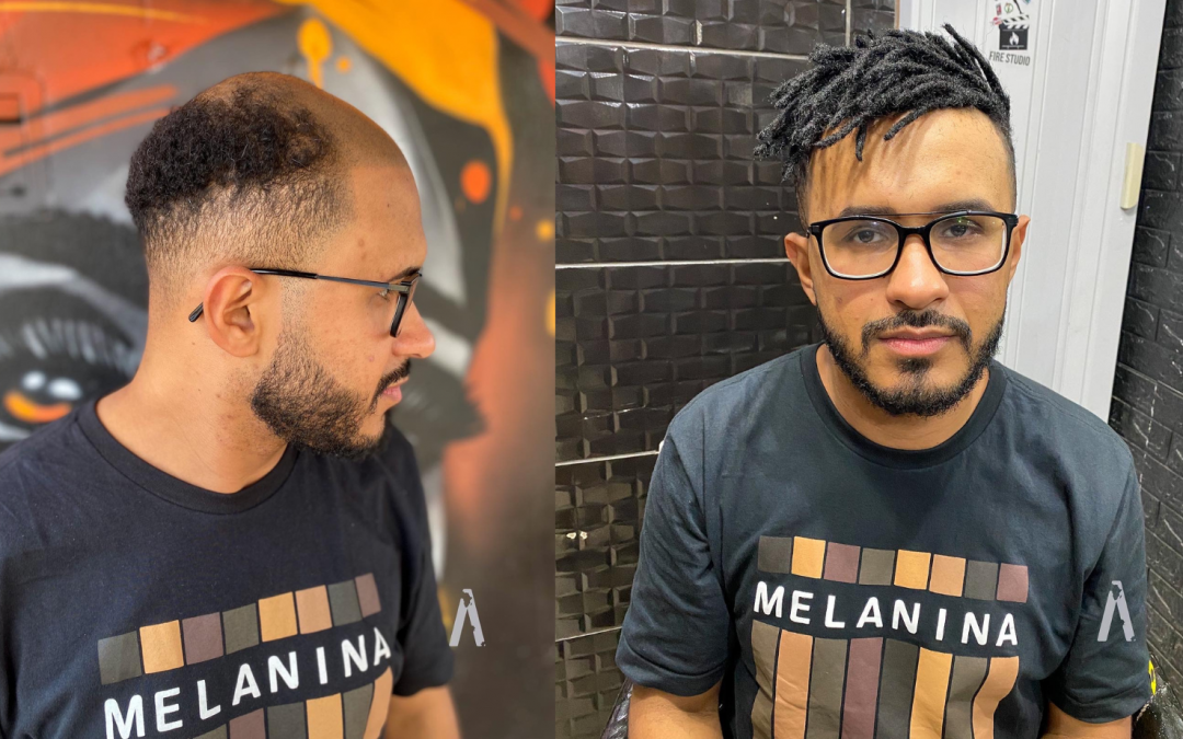 Afroempreendedor carioca leva os ‘baldlocs’, técnica que aplica dreads em calvos, para SP