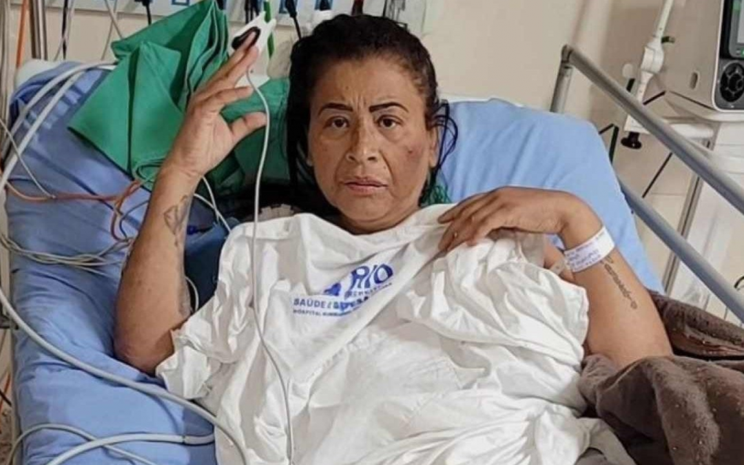 Após duas amputações, ícone do funk MC Katia pede ajuda para conseguir prótese